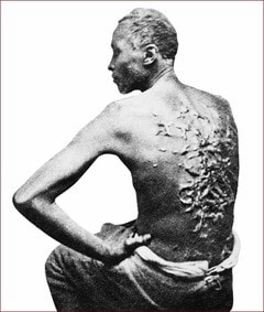 Photo of unknown slave showing his back with scars from repeated whippings. (from public domain)Picture